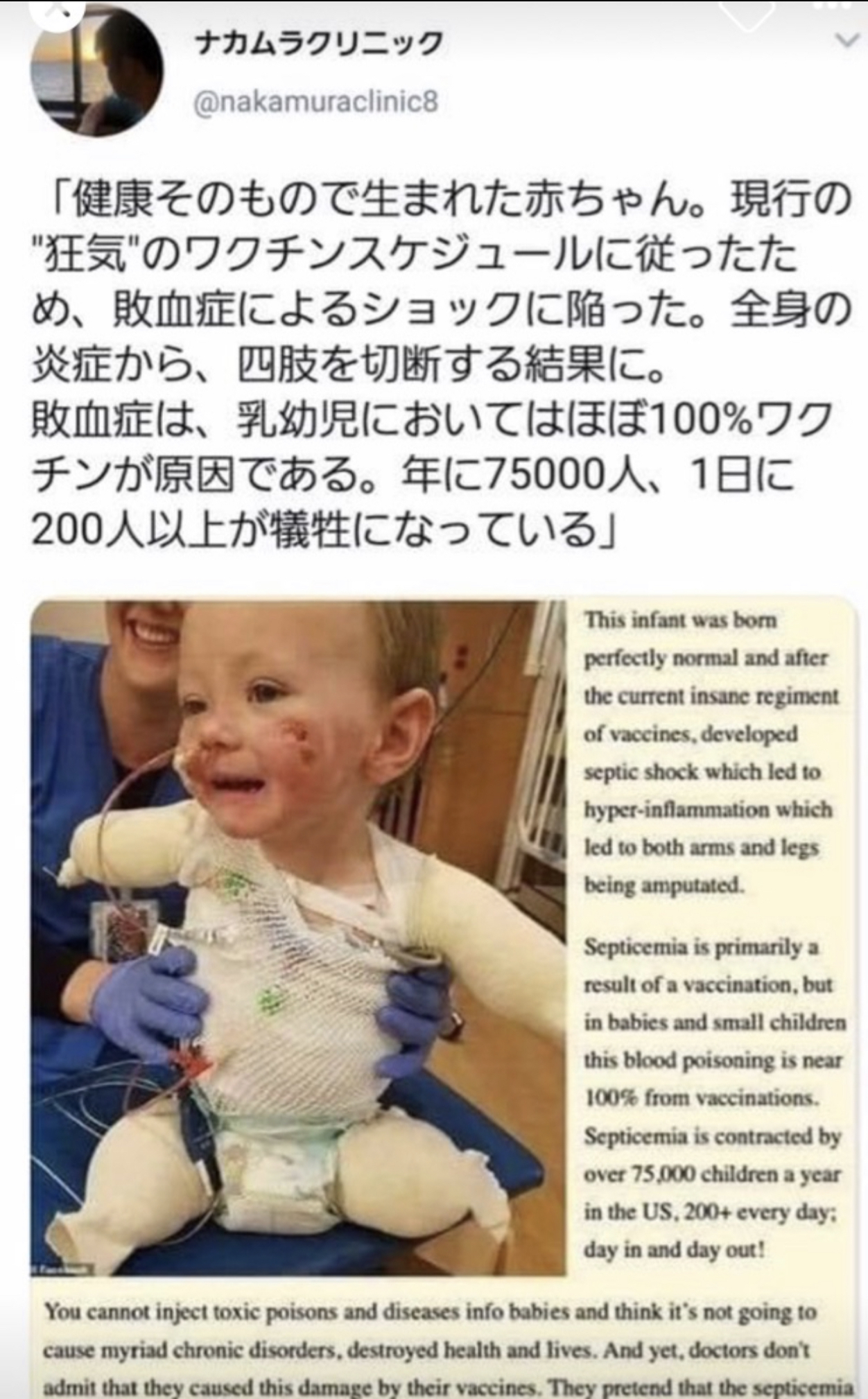 F4AA99B1-7840-451C-9DD3-94BEAB48199F